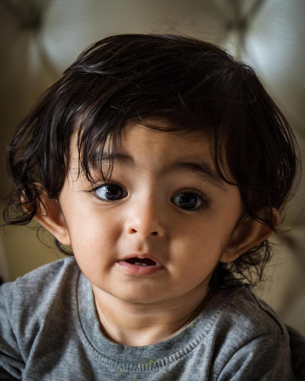 Image of Child, Skin, Eye, Chin, Forehead, Eyebrow etc.