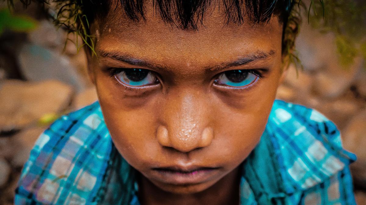 Image of Skin, People, Close-up, Face, Forehead, Hair etc.