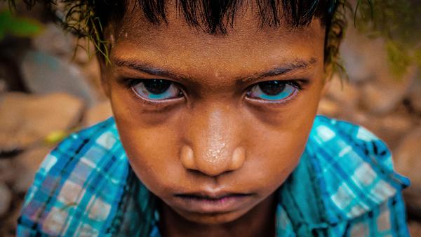 Image of Skin, People, Close-up, Face, Forehead, Hair etc.