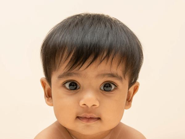 Image of Skin, Head, Eye, Forehead, Eyebrow, Lip etc.