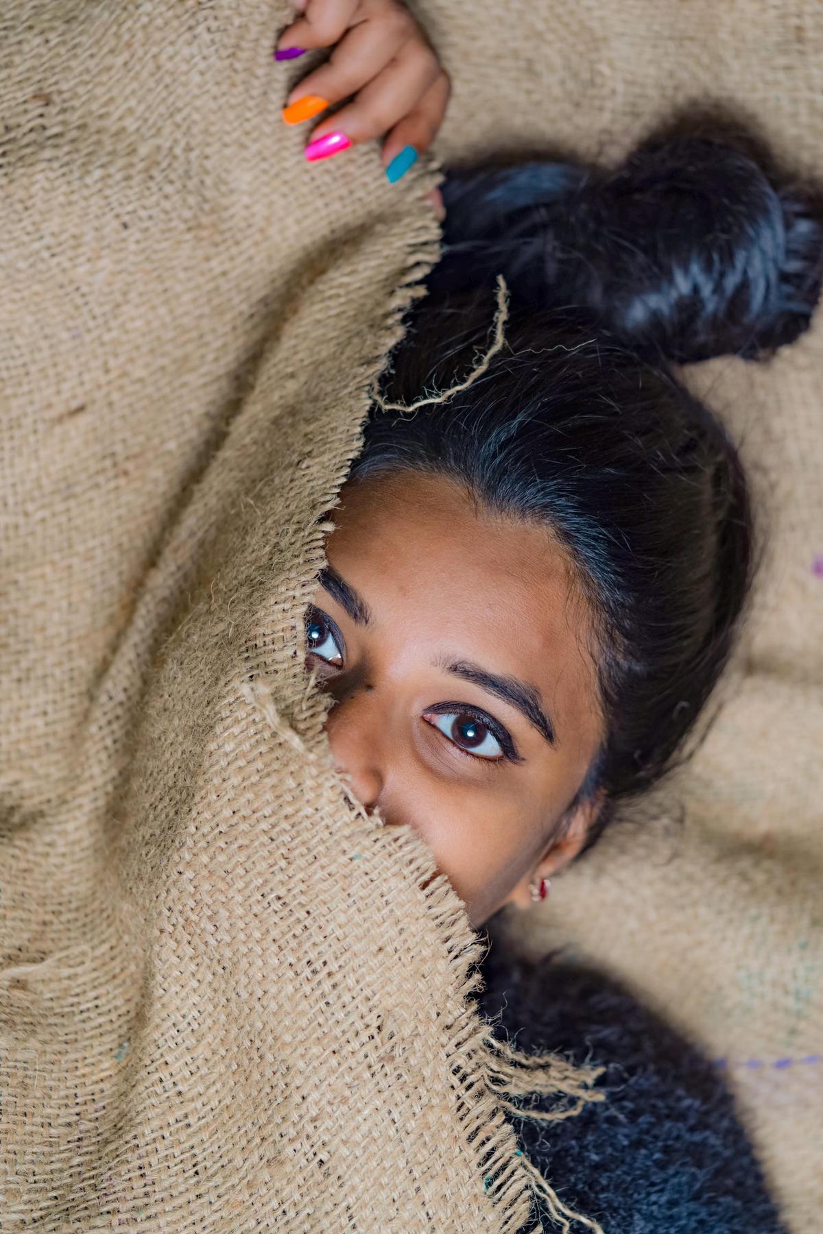 Image of Skin, Head, Face, Forehead, Hair, Eyebrow etc.