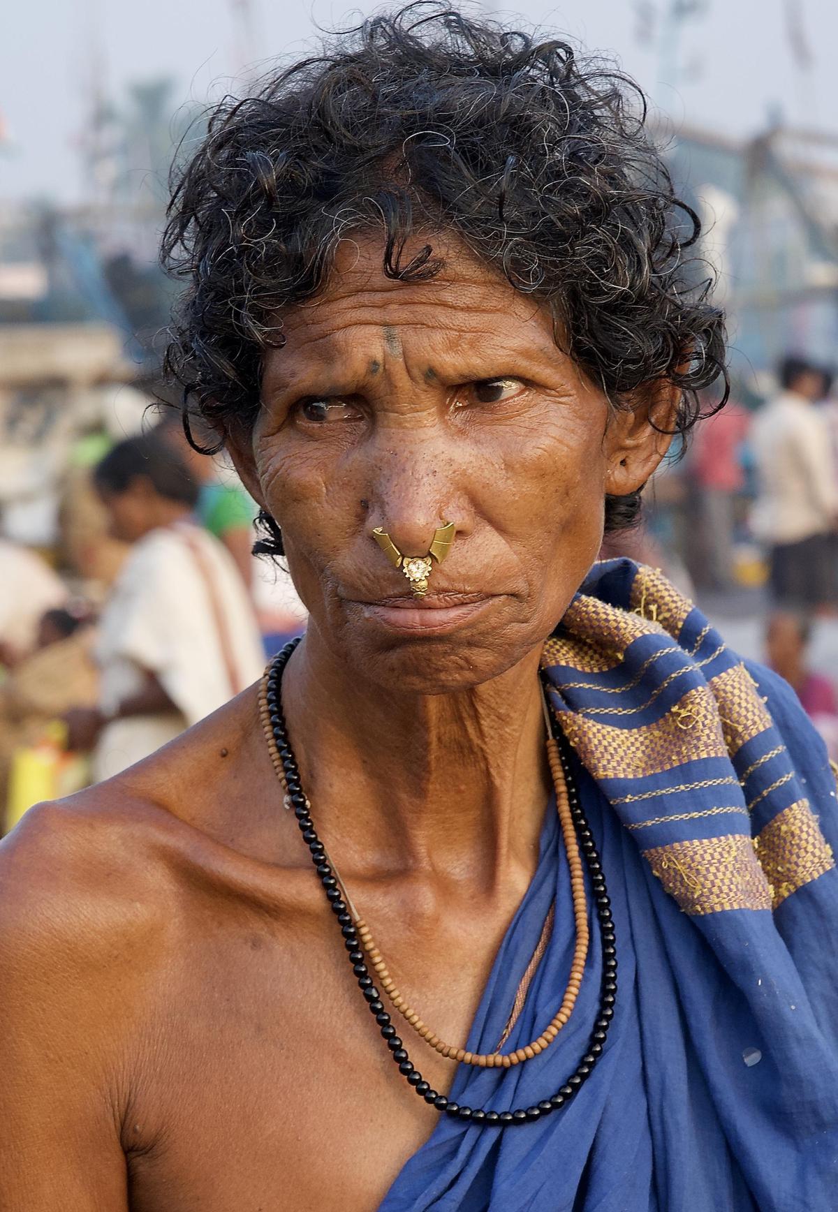 Image of Skin, Head, People, Face, Chin, Human etc.