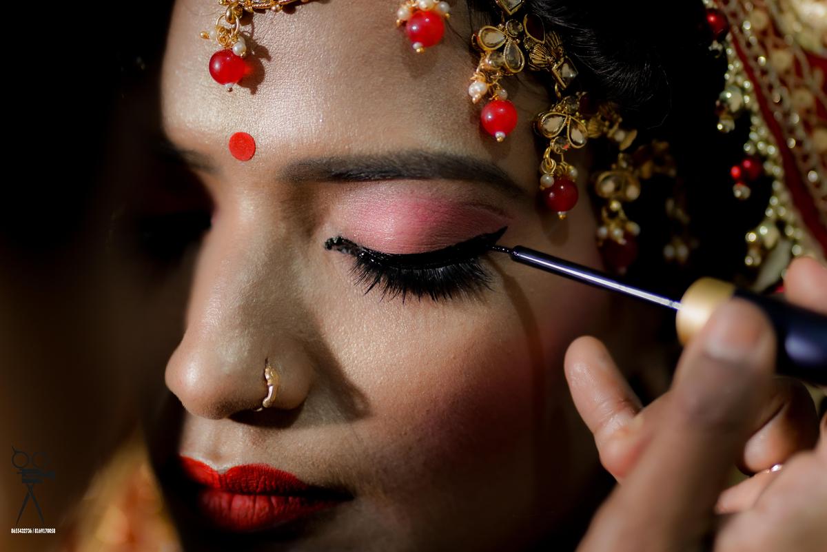 Image of Temple, Chin, Human, Eyebrow, Lip, Eyelash etc.